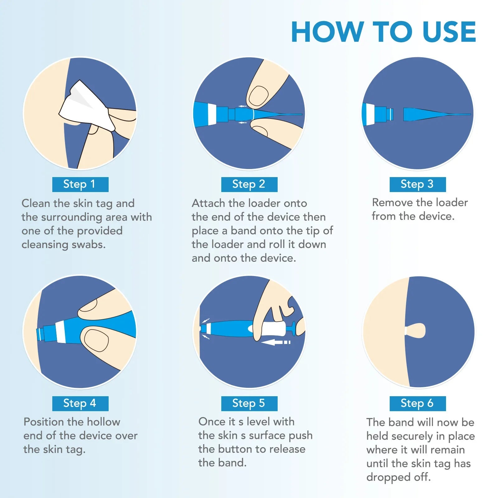 Painless Skin Tag Remover Kit